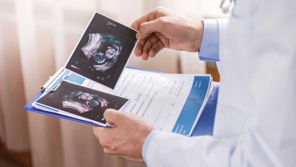 Doctor reviewing pelvic ultrasound reports.